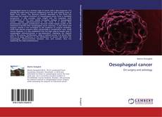 Bookcover of Oesophageal cancer