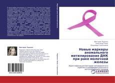 Bookcover of Новые маркеры аномального метилирования ДНК при раке молочной железы