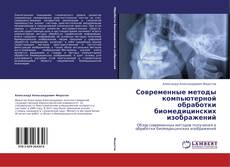 Bookcover of Современные методы компьютерной обработки  биомедицинских изображений