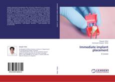 Portada del libro de Immediate implant placement