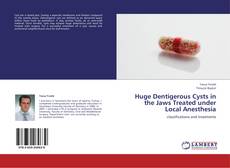 Bookcover of Huge Dentigerous Cysts in the Jaws Treated under Local Anesthesia