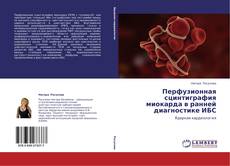 Bookcover of Перфузионная сцинтиграфия миокарда в ранней диагностике ИБС