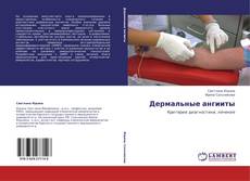 Bookcover of Дермальные ангииты