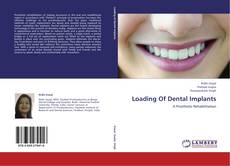 Bookcover of Loading Of Dental Implants