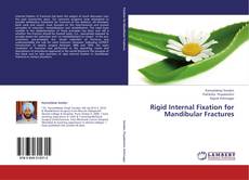 Buchcover von Rigid Internal Fixation for Mandibular Fractures