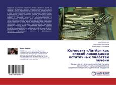 Capa do livro de Композит «ЛитАр» как способ ликвидации остаточных полостей печени 