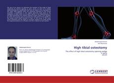 Bookcover of High tibial osteotomy