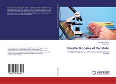 Needle Biopsies of Prostate kitap kapağı