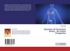 Capa do livro de Overview of Carcinoma Breast - An Indian Prespective 