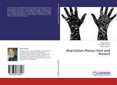 Oral Lichen Planus: Past and Present kitap kapağı