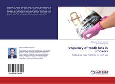 Copertina di Frequency of tooth loss in smokers