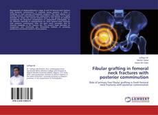 Buchcover von Fibular grafting in femoral neck fractures with posterior comminution