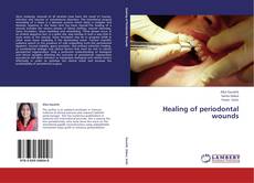 Capa do livro de Healing of periodontal wounds 
