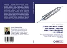 Buchcover von Полная и неполная эндоваскулярная реваскуляризация миокарда