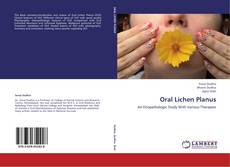 Buchcover von Oral Lichen Planus