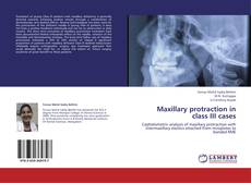 Buchcover von Maxillary protraction in class III cases