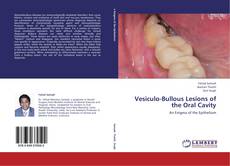 Buchcover von Vesiculo-Bullous Lesions of the Oral Cavity
