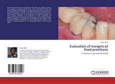 Buchcover von Evaluation of margins of fixed prosthesis