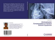 Dentoalveolar Compensation In Various Skeletal Dysplasias kitap kapağı