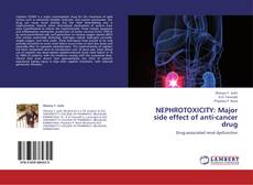 Couverture de NEPHROTOXICITY: Major side effect of anti-cancer drug