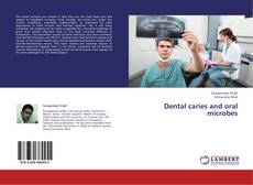 Couverture de Dental caries and oral microbes