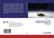 Application of Leech Therapy and Khadir in Psoriasis的封面