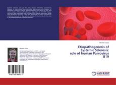 Bookcover of Etiopathogenesis of Systemic Sclerosis: role of human Parvovirus B19