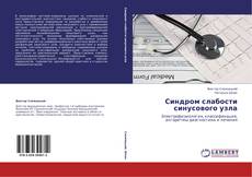 Buchcover von Синдром слабости синусового узла