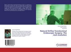 Buchcover von Natural Orifice Transluminal Endoscopic Surgery: The next evolution