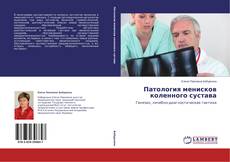 Couverture de Патология менисков коленного сустава