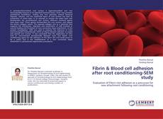 Bookcover of Fibrin & Blood cell adhesion after root conditioning-SEM study