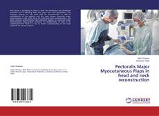 Couverture de Pectoralis Major Myocutaneous Flaps in head and neck reconstruction