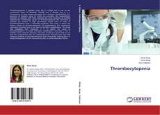 Copertina di Thrombocytopenia