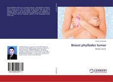 Capa do livro de Breast phyllodes tumor 