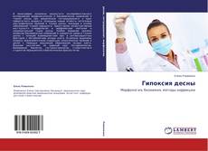 Buchcover von Гипоксия десны