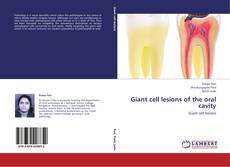 Buchcover von Giant cell lesions of the oral cavity