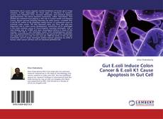 Couverture de Gut E.coli Induce Colon Cancer & E.coli K1 Cause Apoptosis In Gut Cell