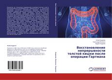 Borítókép a  Восстановление непрерывности толстой кишки после операции Гартмана - hoz