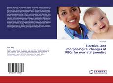 Couverture de Electrical and morphological changes of RBCs for neonatal jaundice