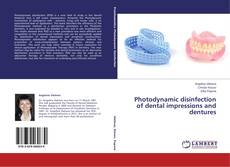Buchcover von Photodynamic disinfection of dental impressions and dentures