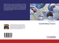 Buchcover von Carotid Body Tumors