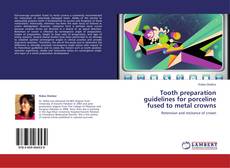 Couverture de Tooth preparation guidelines for porceline fused to metal crowns
