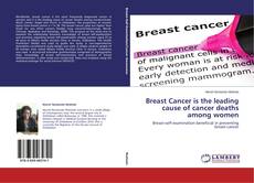 Couverture de Breast Cancer is the leading cause of cancer deaths among women