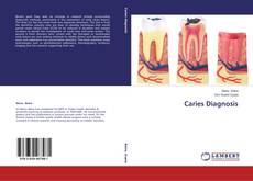 Buchcover von Caries Diagnosis