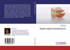Buchcover von Single Implant Overdentures