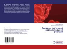 Couverture de Синдром системной воспалительной реакции