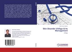 Couverture de Skin Disorder Vitiligo & Its Management