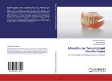 Buchcover von Mandibular Two-Implant Overdentures