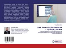Copertina di Рак легких в сочетании с туберкулезом
