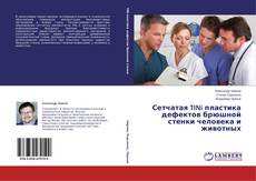 Copertina di Сетчатая TINi пластика дефектов брюшной стенки человека и животных